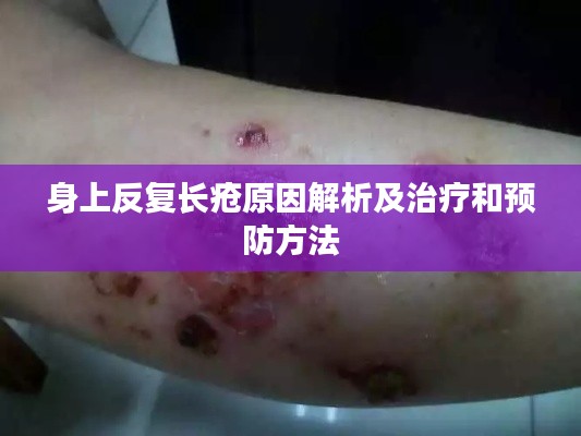 身上反复长疮原因解析及治疗和预防方法