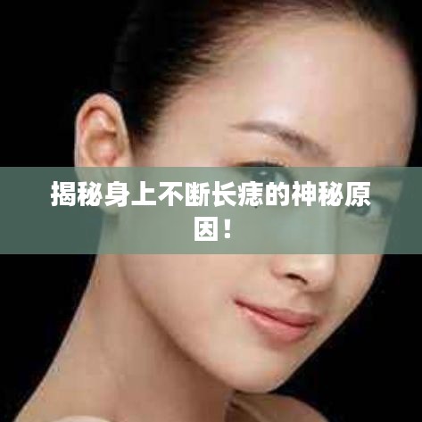 揭秘身上不断长痣的神秘原因！